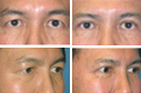 Before & After Photos
